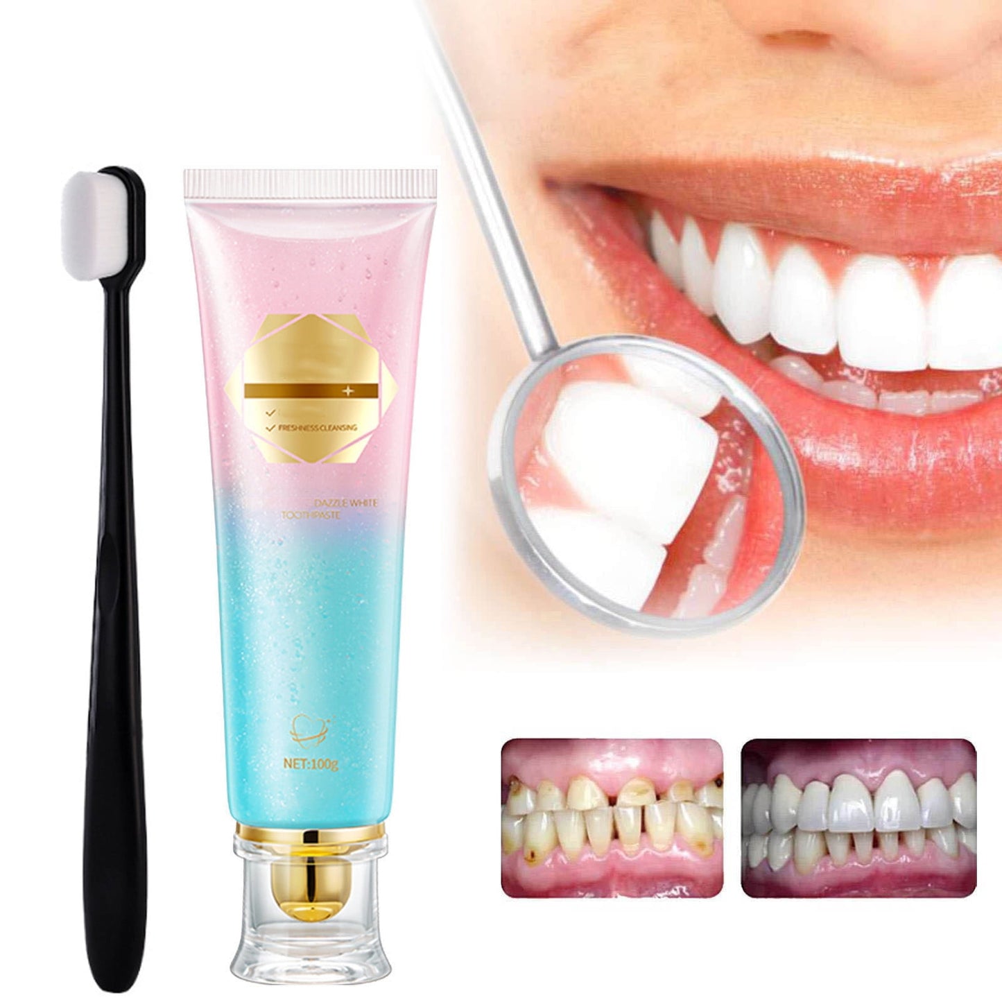 Niacinamide Whitening Toothpaste with Brush, Intensive Stain Removal Toothpaste for Yellow Teeth, Long-Lasting Fresh Breath, Gum Health Support, 3.53 oz