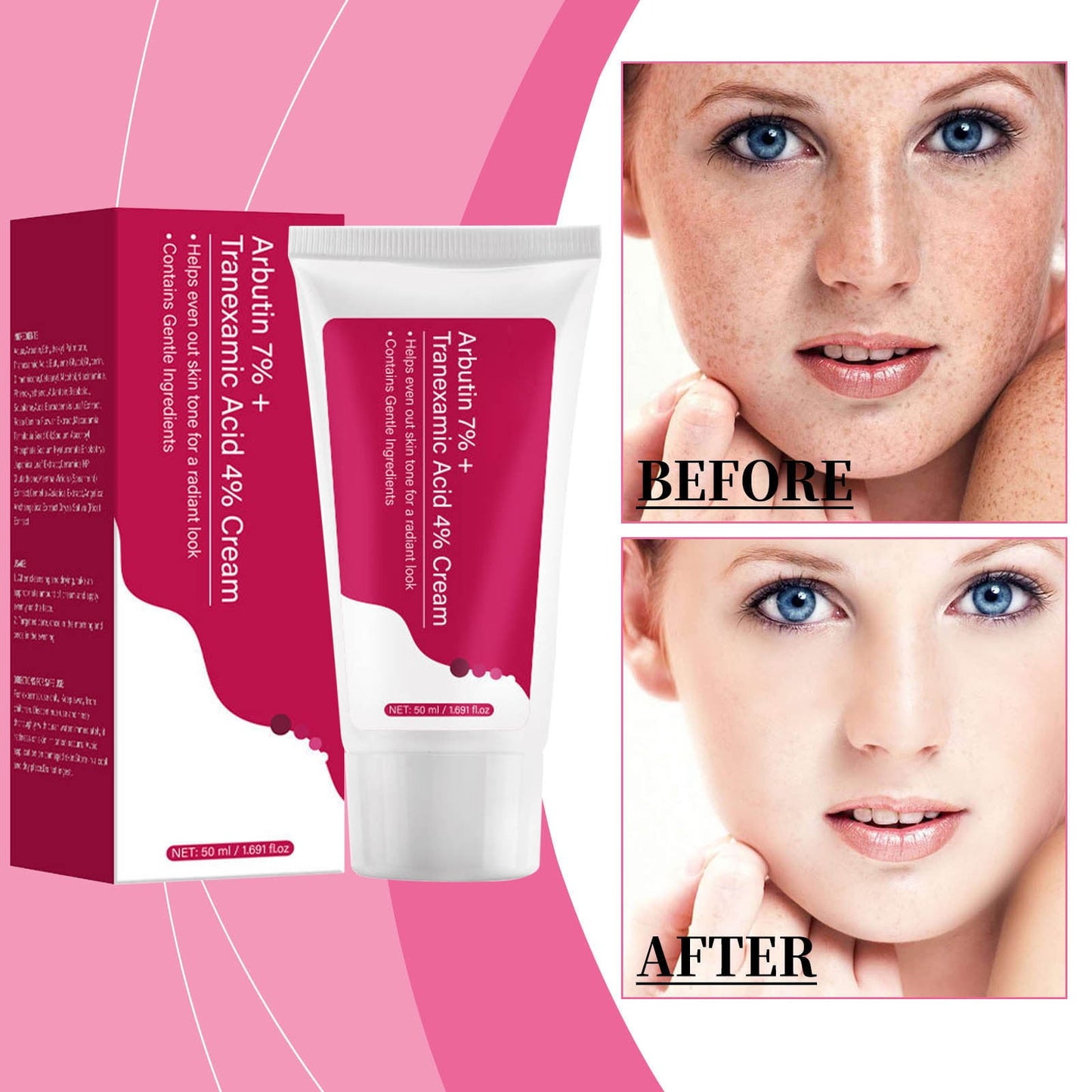 Face Cream for Dark Spots, Skin Freckle Cream, Blemishes, Anti-Pigmentation Korean Skin Care, Tranexamic Cream for Dark Spots Freckles Blemishes & Hyperpigmentation Care, 1.69 Fl Oz