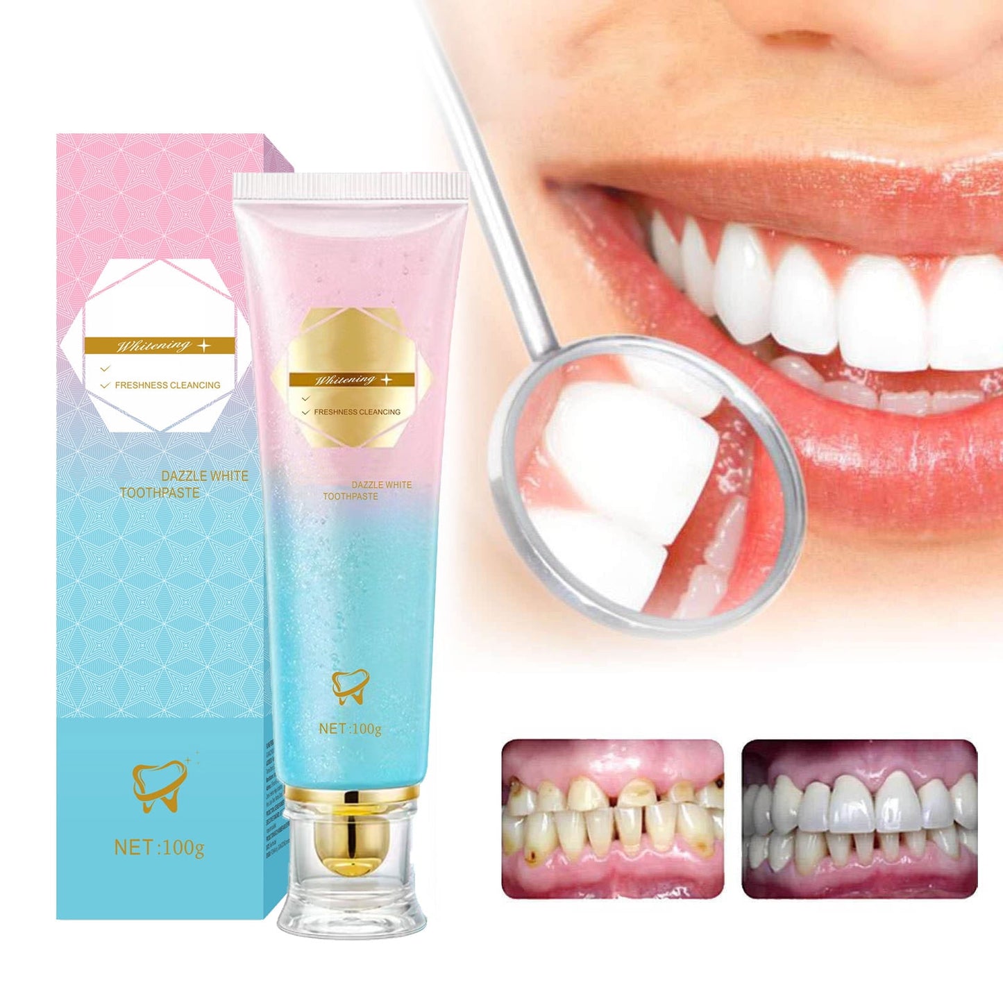 Niacinamide Toothpaste, Intensive Nicotinamide White Teeth, Deep Cleaning Care, Enamel Safe Whitening & Stain Removal, 3.53 oz/ 100g
